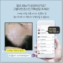 모가한의원 네이버블로그
