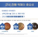 동글라스 이미지