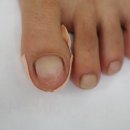 아이캔네일 이미지