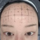 윤의원 | 구의역 피부과 맑은윤의원 써마지 300샷 후기