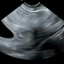 레지나 산후조리원 이미지