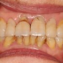 웃는오늘치과의원 이미지