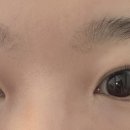 JK서울안과의원 네이버블로그