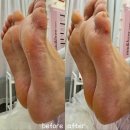 미유앤브로우 | 분당발각질관리 미유앤브로우 베이비풋필