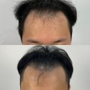 모타브 | 모타브 두피 smp 후기