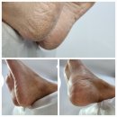 뷰티드윤 | 뷰티드윤 패디플래닝 후기