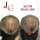 제이콤마SMP