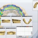 앞선치과기공소 이미지