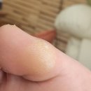 봉쟈네일