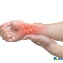 왼쪽 오른쪽 손목 통증 원인 방법 이미지