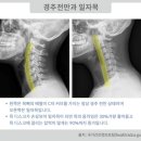 대구한빛정형외과의원 | 목 통증과 거북목증후군, 대구 한빛 정형외과 도수치료사가 알려드리는 예방법