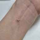 헬씨이어 기석 귀지압스티커 활용한 셀프 귀지압패치 리얼 사용법 후기