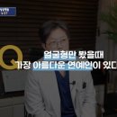 성형외과 의사가 말하는 가장 아름다운 얼굴형은 정윤희 이미지