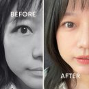 1001안경위드렌즈 이미지