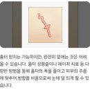 스타피부과의원 | 흉터 치료 병원 비교 (안성열 성형외과 보니따 연세스타피부과 아문성형외과) 레이저 수술 가격