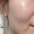 뽀얀피부만들기 | 단 돈 3만원대 홈케어로 잡티없는 뽀얀 피부 만들기 '닥터라비오 셀라넥산 멜라논 크림' 기미제거 후기