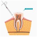 송탄골드만치과의원 | 송탄치과? 치료 통증이 걱정이라면 <필독>