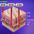 고주파체험방 이미지