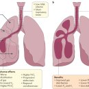 RR-34[삼동로]-하-10 | 소아청소년과 실습 3주차: 신생아분과