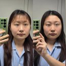 미도1차(아) 경로당 | 부평구청역 피부관리 부평엘리뉴｜물방울리프팅 후기 (속건조·승모근 케어)