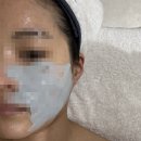 피부천재연구소 | 🌿 대구피부관리 피부천재연구소 방문 후기세멘시트 + 세멘팔트 관리