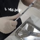 충주시청환경노동조합 | 리투오 스킨부스터 내돈내산 시술 후기 통증 효과