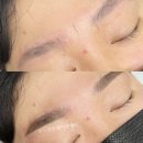 피부앤두피아카데미 네이버블로그