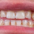 메가플란트치과의원 이미지