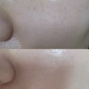 동화약국 | 동화제약 멜라논크림 사용 후기 기미제거