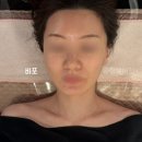 영등포피부관리 연예인만들기 에스테틱 작은얼굴관리 받고 온 후기