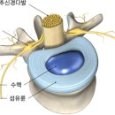 서재곤링커병원 | 드디어 허리통증으로부터 탈출! 안중PT 라이프짐