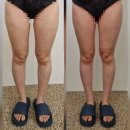 유성전기 - 남구 서문대로 477 | [마메드오 에스테틱]대전 유성구 하체관리 후기, 도안동 바디관리 추천