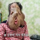 혼돈의 인간! /‘신경섬유종?‘ 심현희 사망?/ 불치병, 치매, 희귀난치병은 왜 발생되는가? /&#34;인간의 무지. 지식의 저주/ 일념법 진리? 이미지