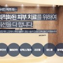 인샤인 이미지