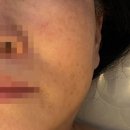 [창원 에스테틱 추천] 올오브뷰티, 하이푸리프팅 솔직하고 자세한 후기 주차 관리종류 가격