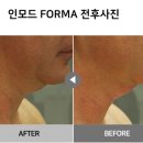 드라마피부과의원 네이버블로그