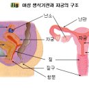 자궁경부암 이미지