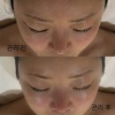 마인테라피 | 안양 웨딩관리로 유명한 메종드마인 안양범계점, 잼테라피 수분 케어 후기