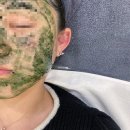 대구 수성구 예신관리 미친 물광 후기 디브 스킨&amp;뷰티 범어점
