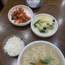 드디어 안경잡이 탈출한 후기 feat. ㅂㅇㅂ 스마일라식