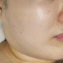 프라임한의원 | 신도림피부관리 / 구로피부관리 비욘더 에스테틱 페이스 프라임 리커버리 솔직 후기