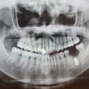 김플란트치과의원 이미지