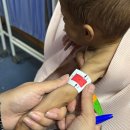 아프가니스탄: 남부 지역에서 중증 영양실조 아동 입원 급증 이미지