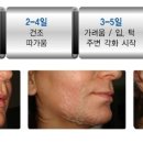 트로이샵
