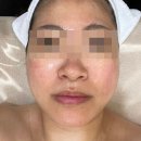 처인구 피부관리 에스테틱원아워 3V 윤곽관리 첫방문 이벤트 할인까지 알뜰하게 챙기세요