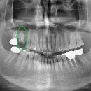 나뭇잎치과의원 이미지