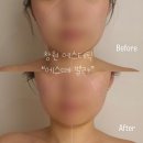 삼정자초등학교 | [창원/에스테틱] 꼼꼼하고 손맛장인 사장님 “에스떼 벨라” 찐강추후기