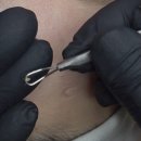 바이오에스테 | 경북신도시피부관리 청담에스테숲 바이오리필 후기