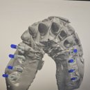 거목치과기공소 이미지