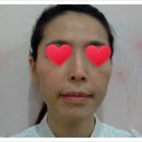 샤넬림스킨케어 이미지